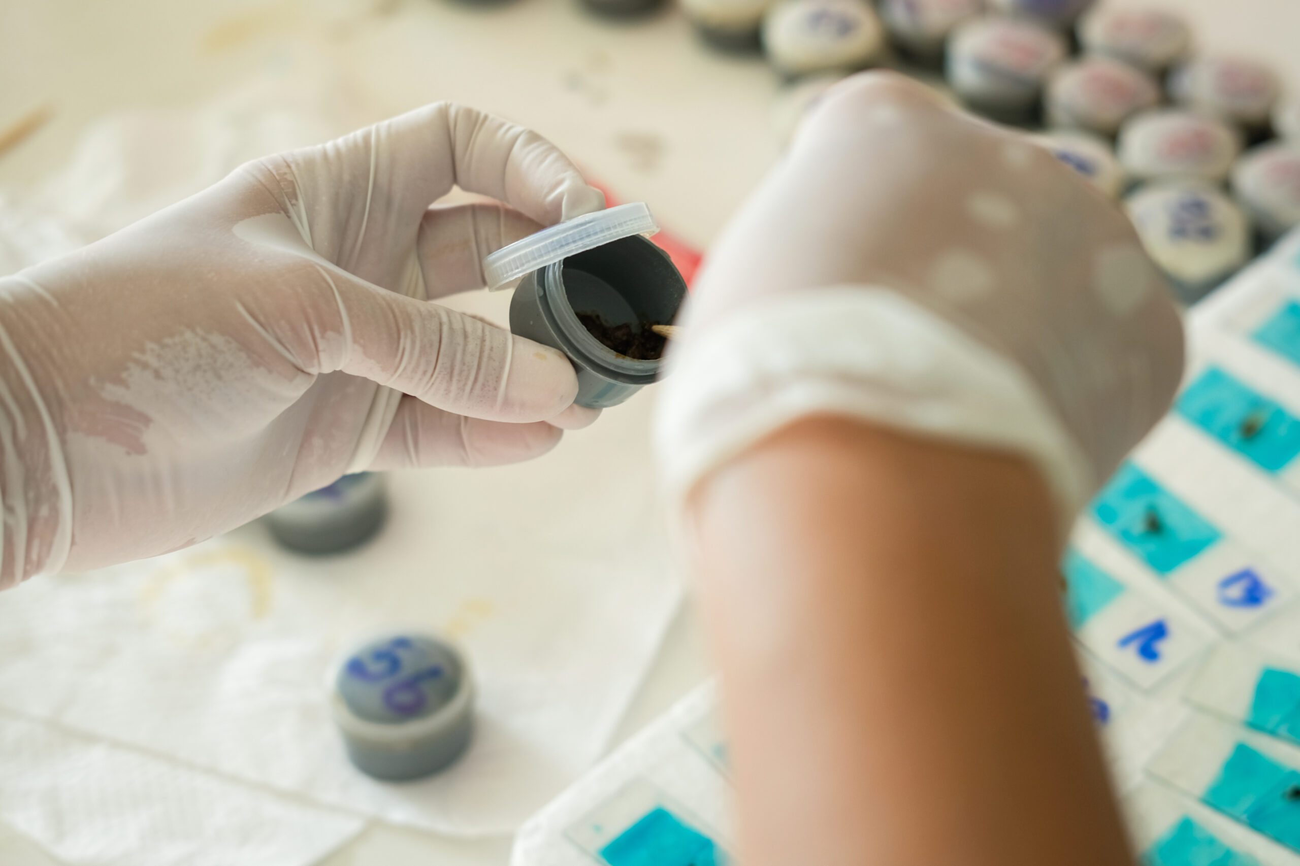Stool Sample Screening