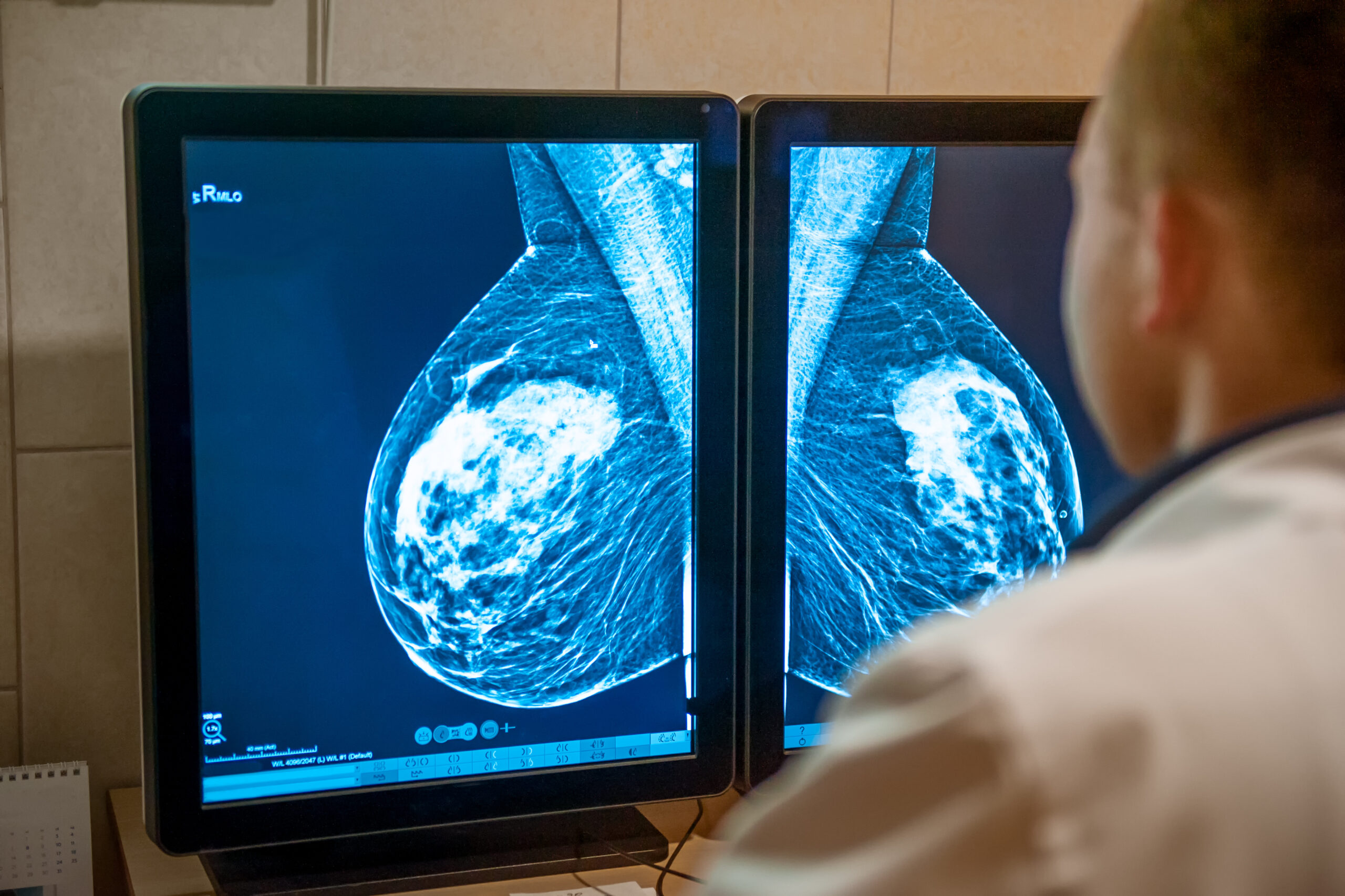 preventive cancer screenings