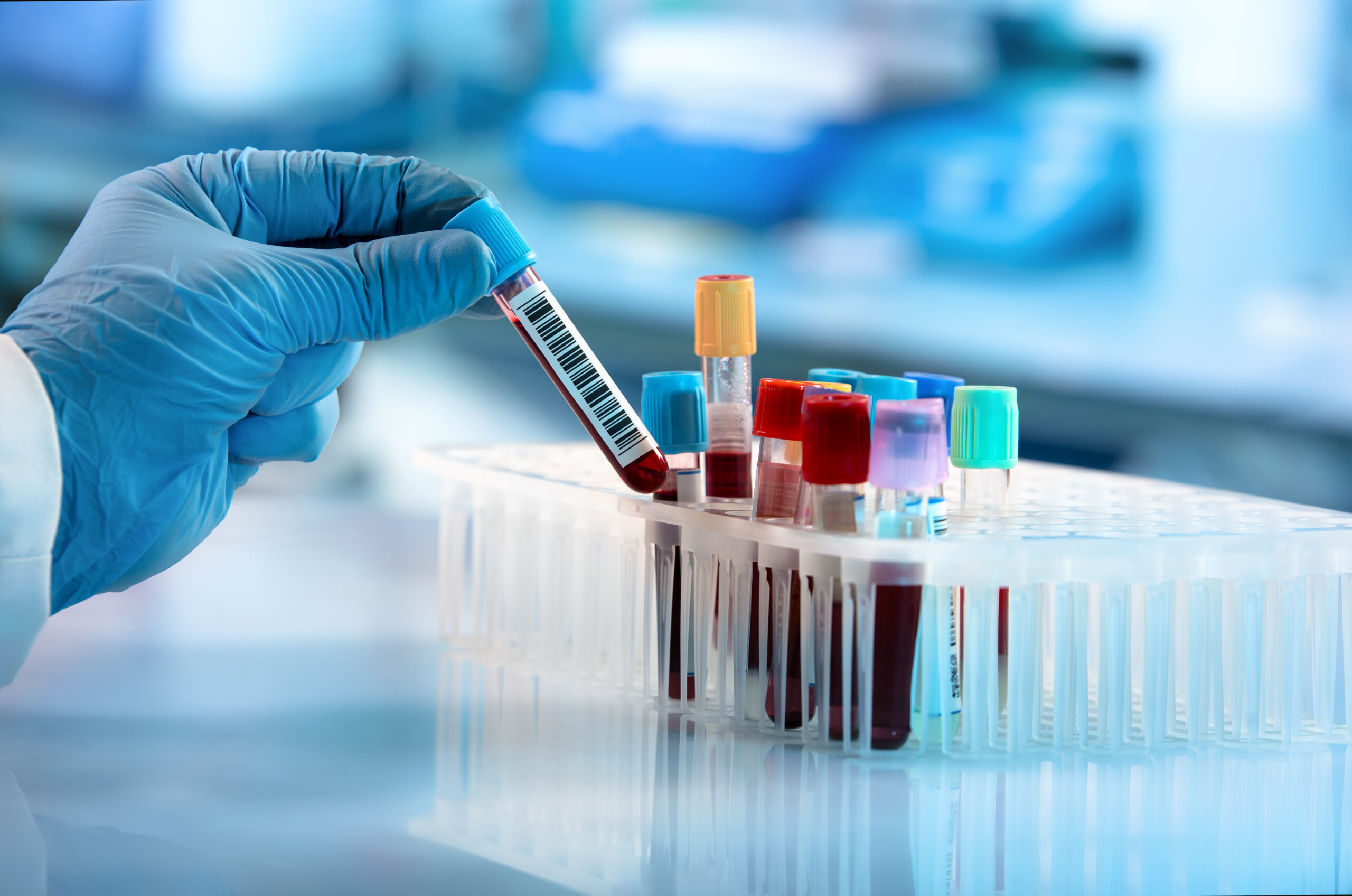 Blood Test Screening 