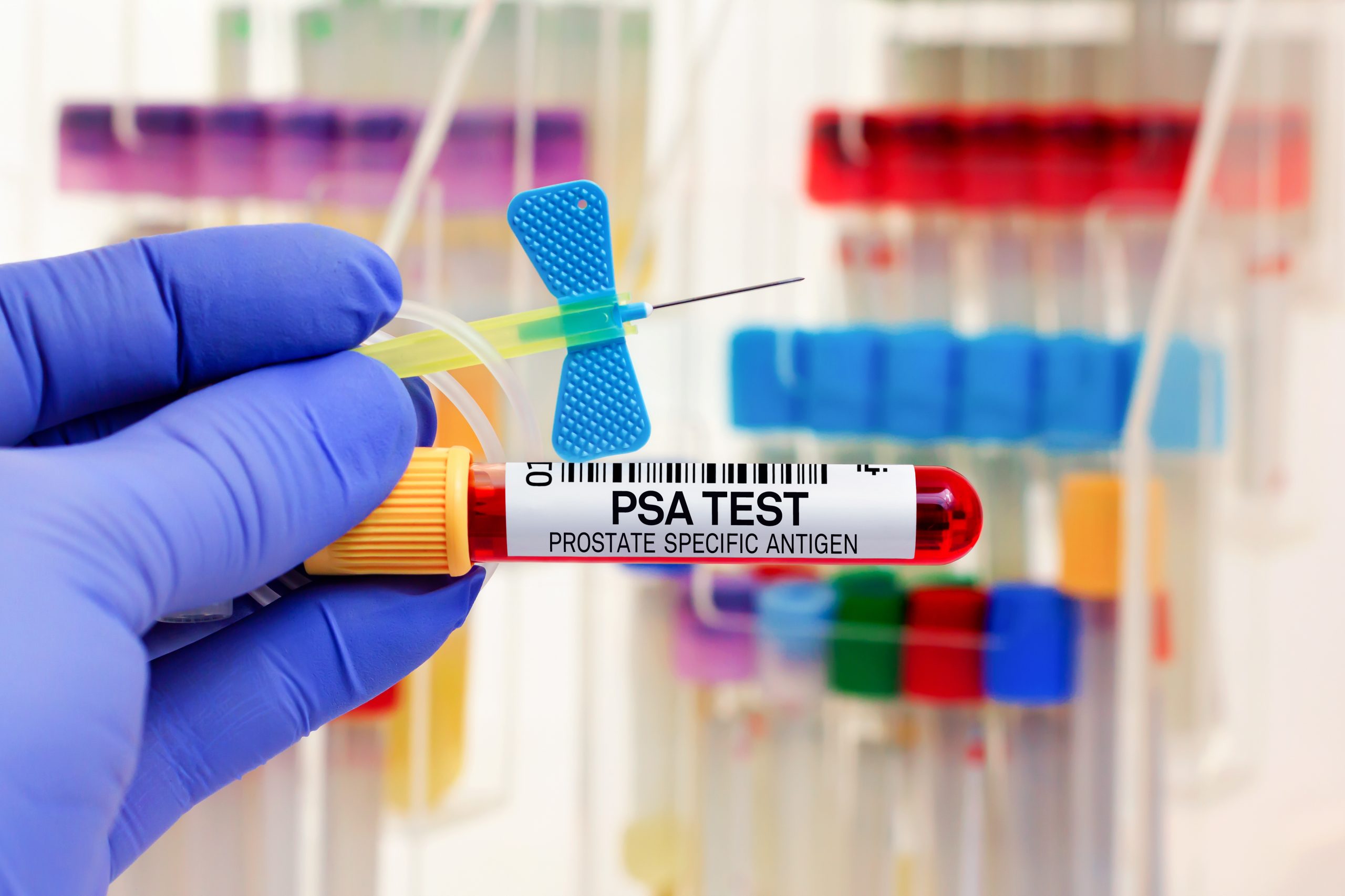 PSA test for cancer screening, Live Longer WED